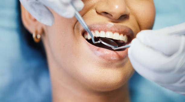 Best Emergency Wisdom Tooth Extraction in Hilbert, WI
